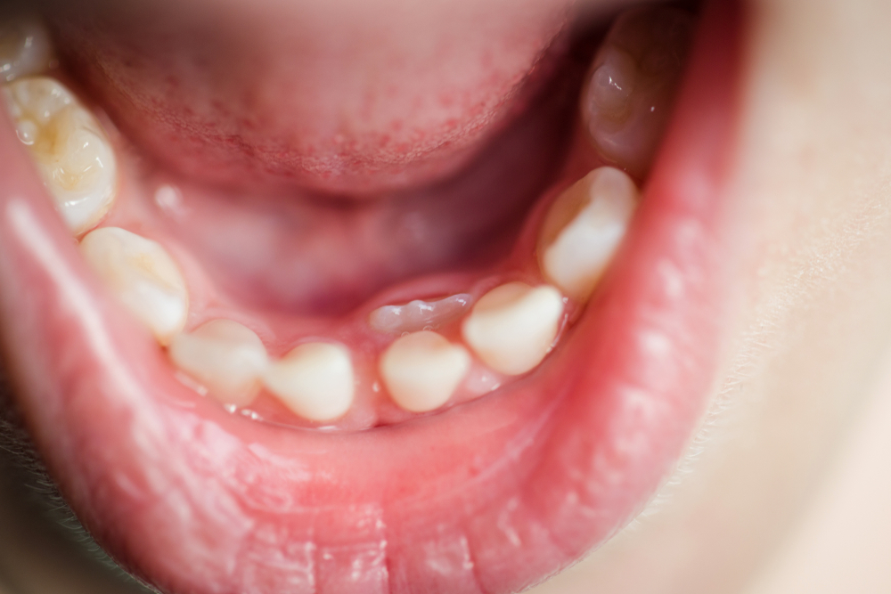 Co dělat když rostou zuby?